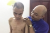 Diễn viên Nguyễn Hoàng tiều tụy, hốc hác nhập viện lắp lại hộp sọ